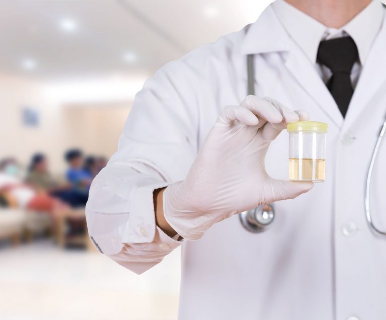 The Pee Test – Are YOU Drinking Enough Water?